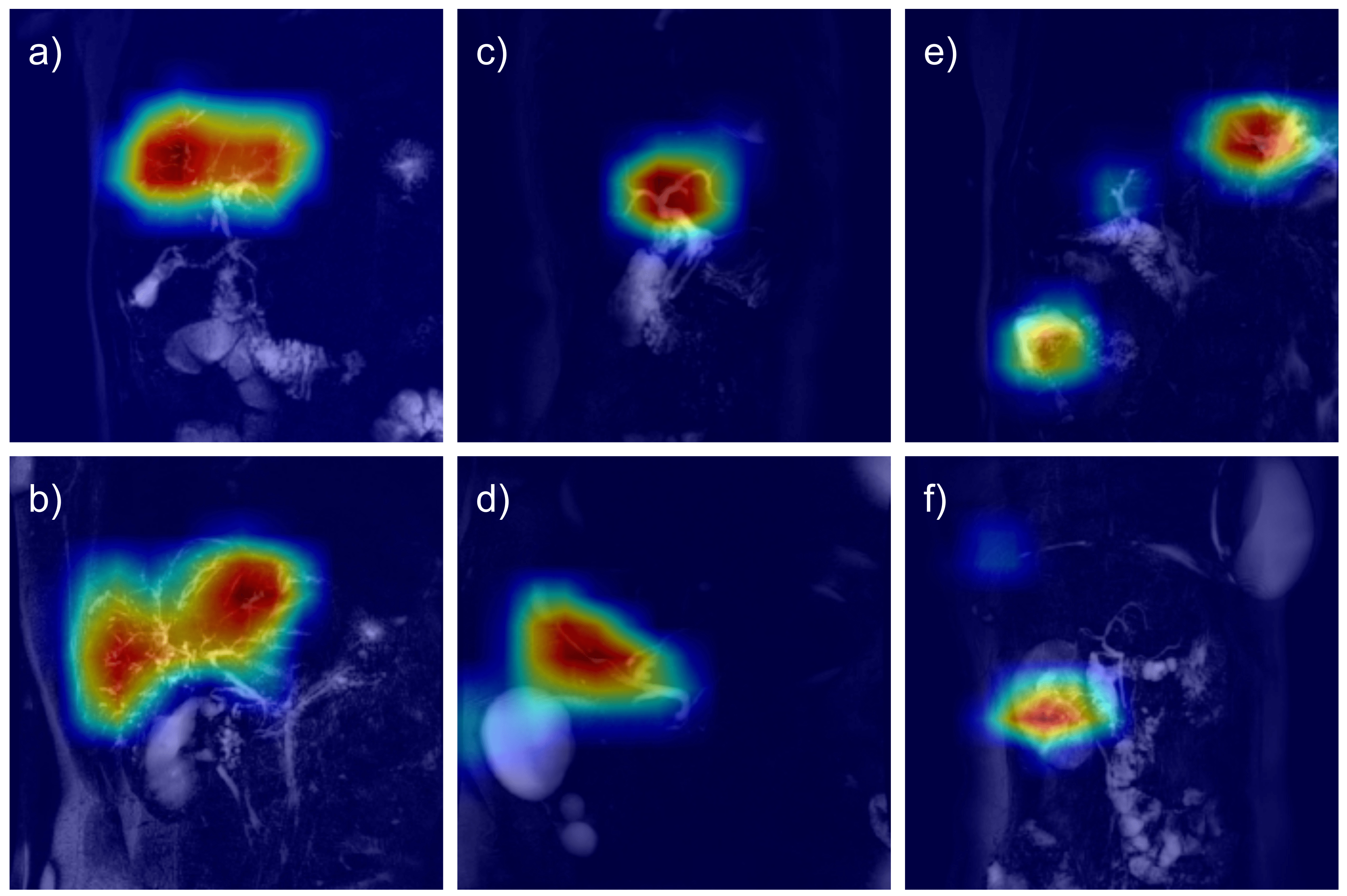 DeePSC: Automated Diagnosis of Primary Sclerosing Cholangitis