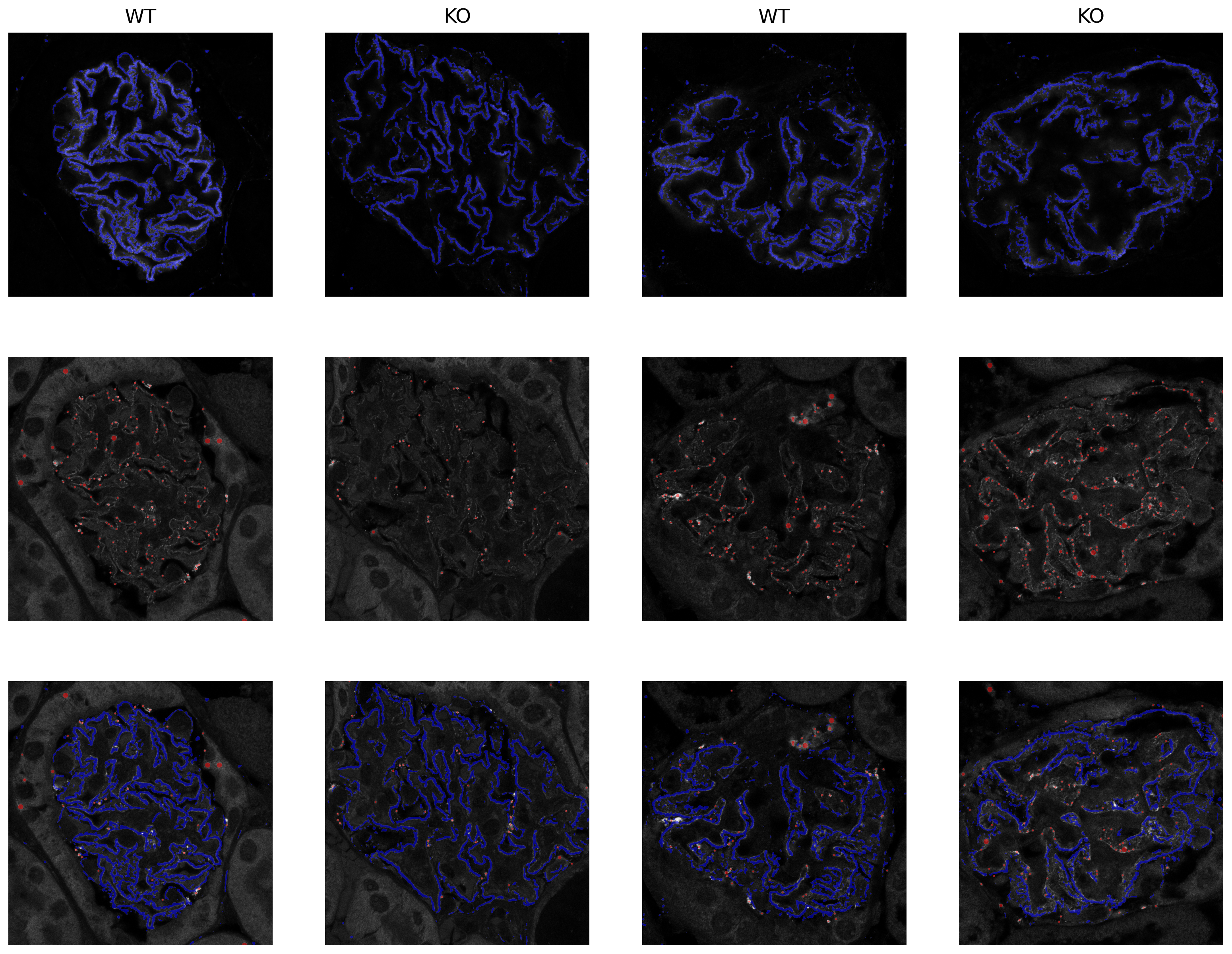 Kidney Glomeruli Classification